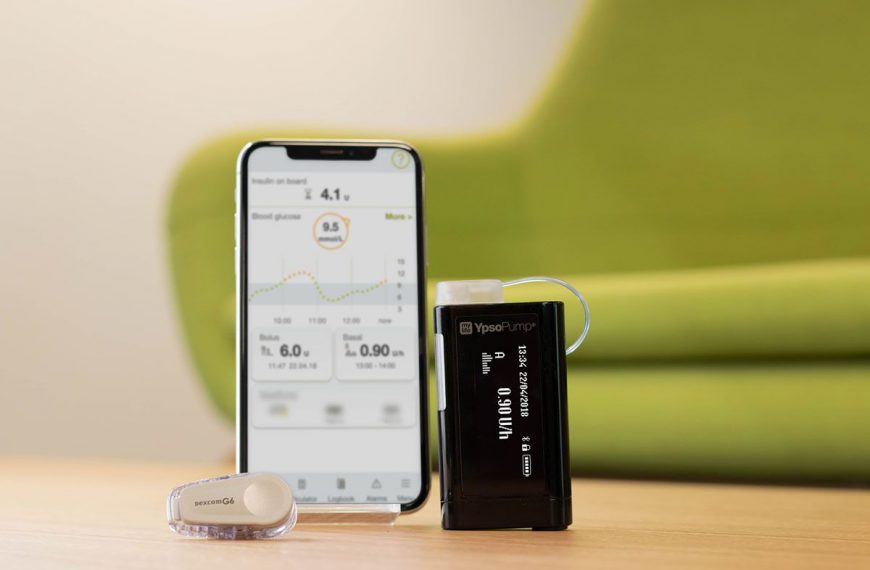 Zamknięta pętla z pompą YPSOMED i Dexcom G6