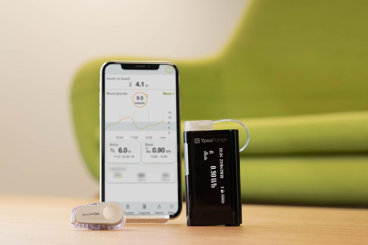 Zamknięta pętla z pompą YPSOMED i Dexcom G6