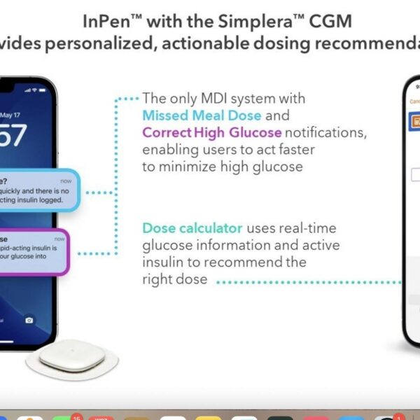 CGM Simplera od Medtronic