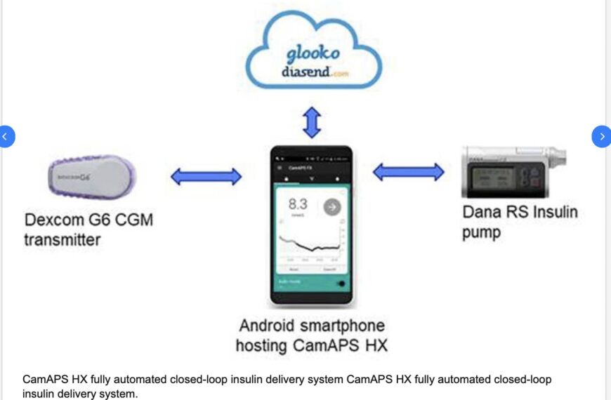 CamAPS HX algorytm dla CT2